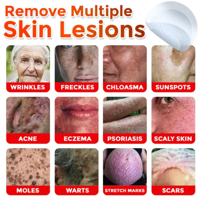 ✨Last Day Buy 2 Get 1 Free✨GFOUK Removal Patch